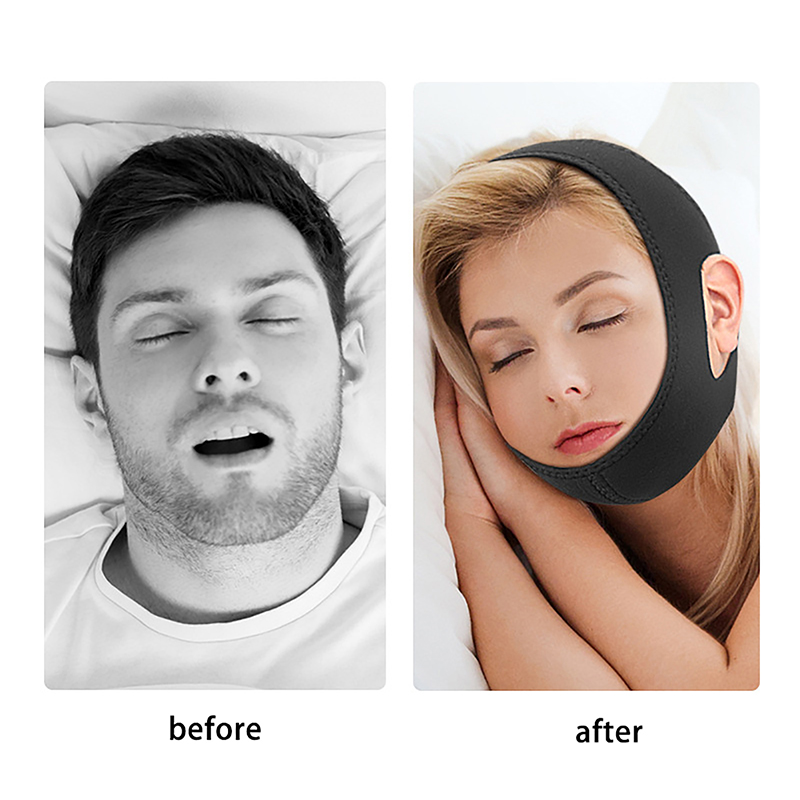 조절 가능한 새로운 네오프렌 코골이 방지 스트랩, 코골 - Anti Snore Chin Strap Adjustable 리뷰 및 가격